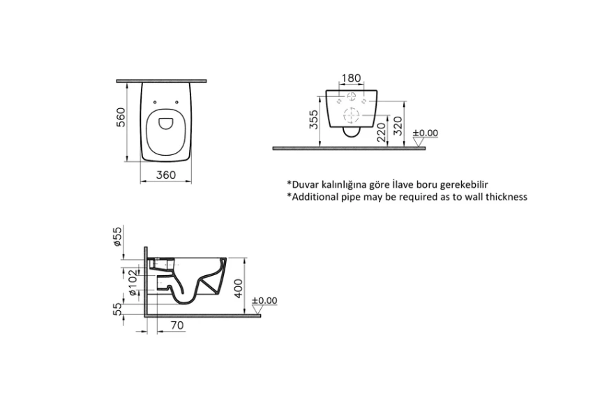 Унитаз подвесной VitrA Metropole 7672B0 безободковый (детальная фотография), подвесные, встраиваемые