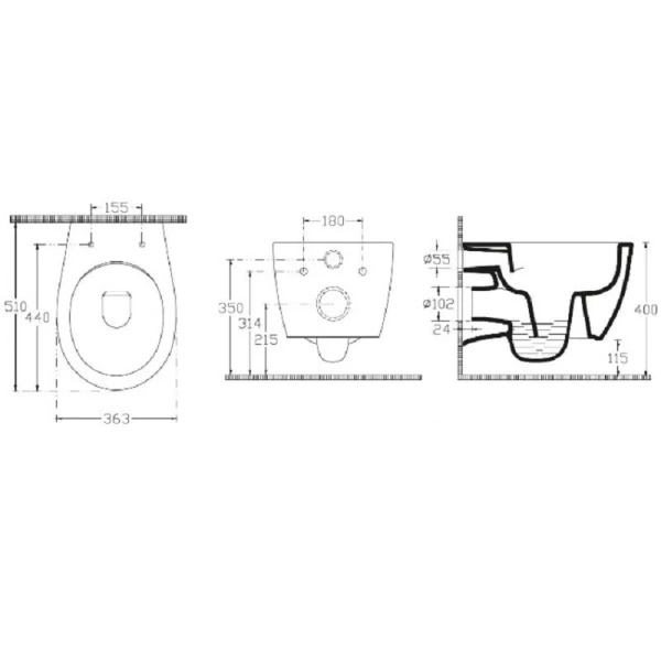 Унитаз подвесной Allen Brau Fantasy со смесителем 4.11HC1.20 (детальная фотография), подвесные, встраиваемые